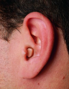 Aparelho auditivo micro-canal